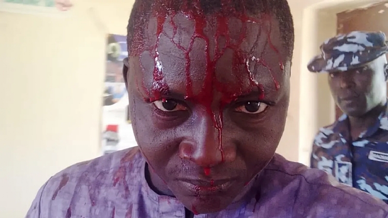 Nigerian Police Beat Journalist Muhammad Sani Adamu During Eid Celebrat