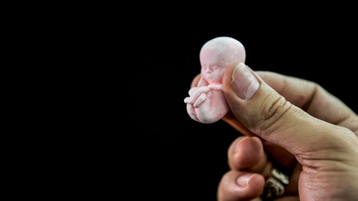 Inside The Deadly World Of Abortion Doctors In Lagos (An Undercover Investigation) - The Nigerian Voice