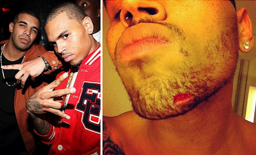 Chris Brown And Drake Fight Over Rihanna In Nightclub 