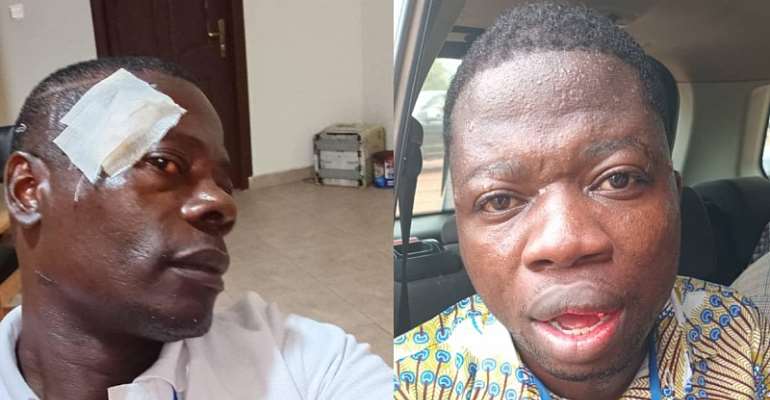Angel Broadcasting Network reporter Gabriel Kwasi Oppong (left) and GhanaWeb correspondent Gideon Nana Peprah (right) were among five journalists attacked while covering Council of State elections in Ghana. 