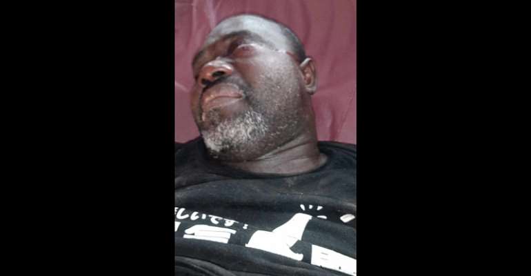 Talk show host Kasselee Sumo after he was assaulted on March 11, 2024, by two officers with the Liberia Drug Enforcement Agency and a magistrate's court sheriff. (Photo: Courtesy of Press Union of Liberia)