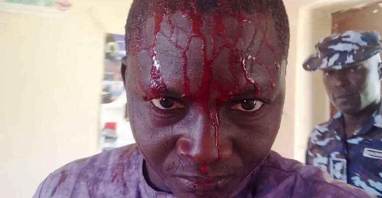 Muhammad Sani Adamu, a reporter with privately owned Albarka Radio, was attacked by police in Nigeria's northeastern Bauchi state on March 22. (Photo: Courtesy of Albarka Radio)